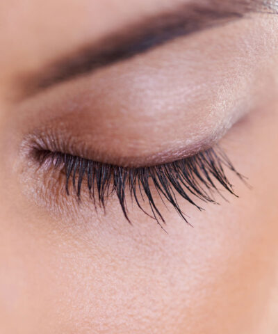 Eyelid Surgery Right